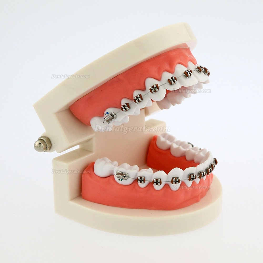 Dental Teach Typodont Demonstrationszahnmodell mit Zahnspangen F&uuml;r die Patientenstudie 5006